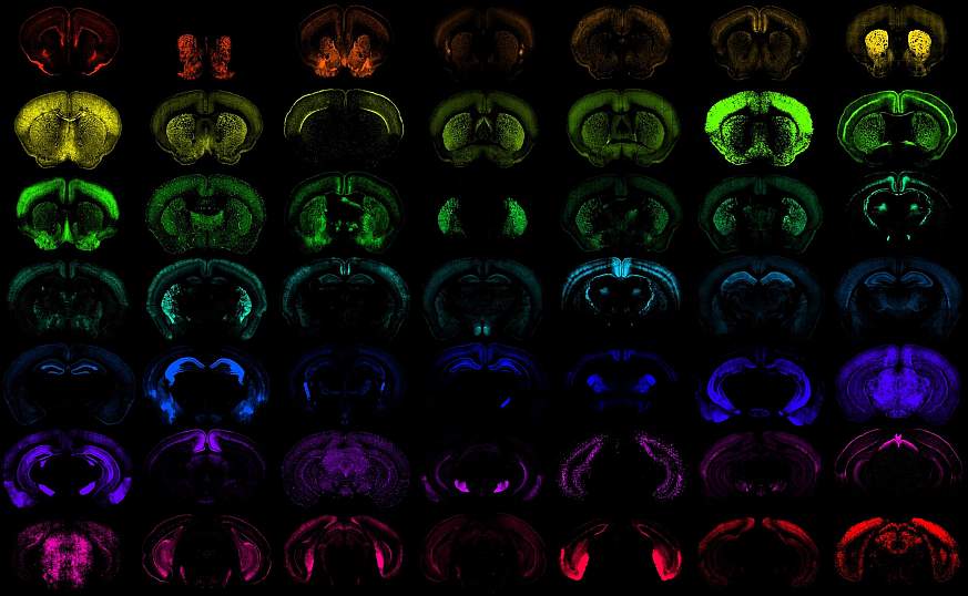 درمان بیماری های مغز و نخاع